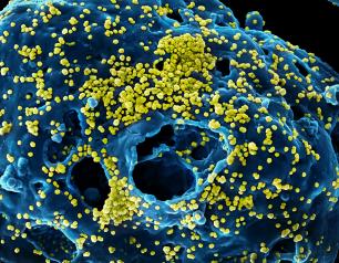 Emerging Infectious Diseases Photo